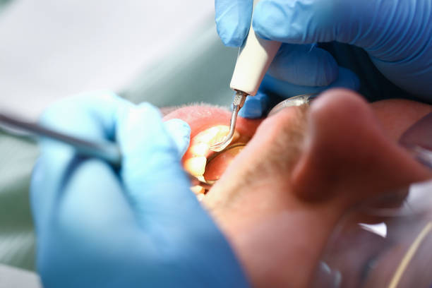 Best Emergency Root Canal Therapy in Los Fresnos, TX